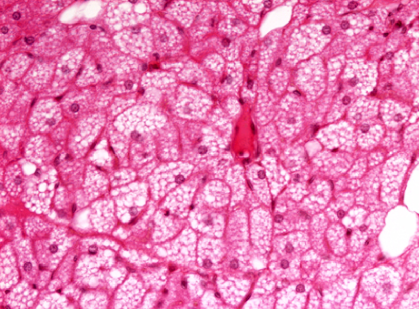 Tecido Adiposo Histologia Interativa Tecido Adiposo Histologia Interativa