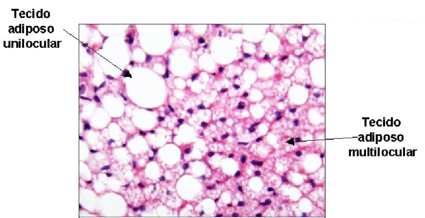 Tecido Adiposo Histologia Interativa Tecido Adiposo Histologia Interativa