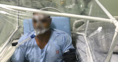UNIFAL-MG produz cabine de Ventilação Não Invasiva para pacientes com Covid-19; primeira estrutura já está em uso na Santa Casa de Alfenas